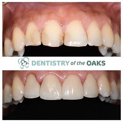 Picture one of our top rated dental work