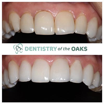 Picture four of our top rated dental work